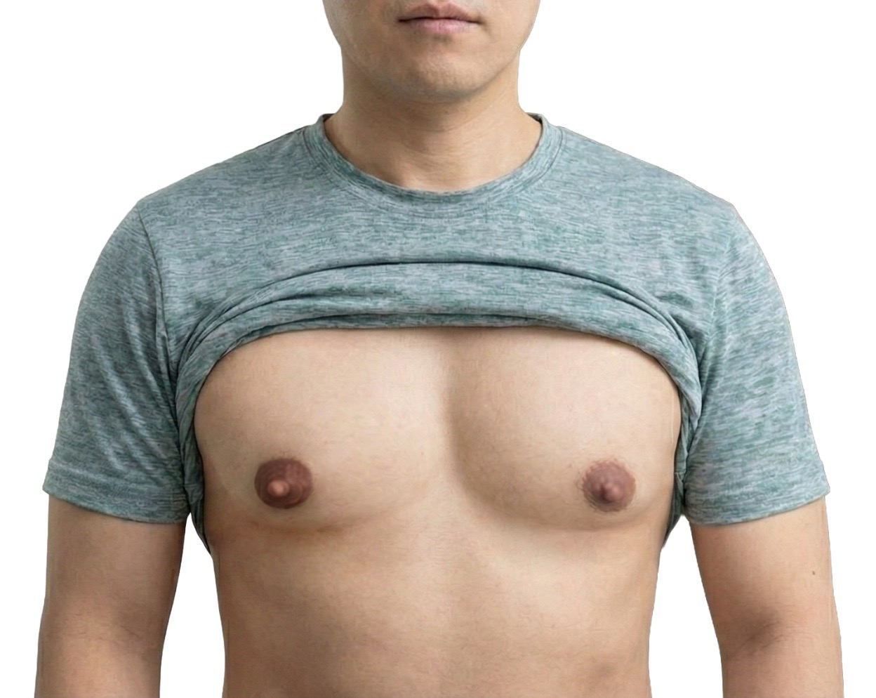 유두축소수술을 진행안한 경우