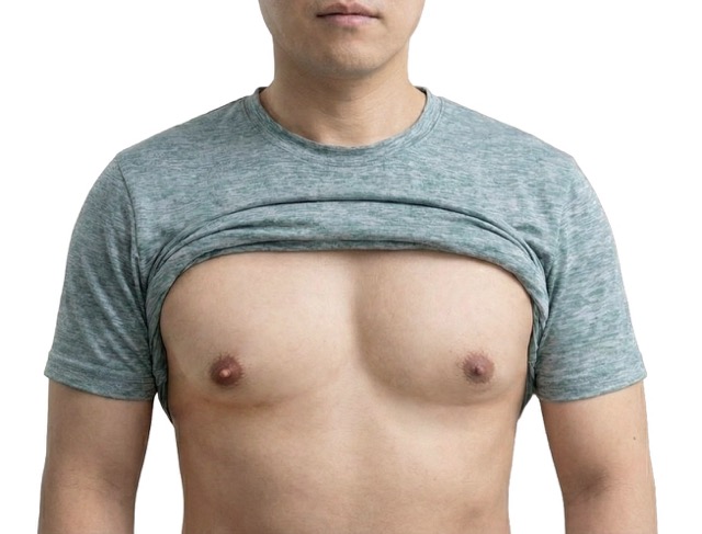 여유증수술과 유두축소수술을 모두 진행한 경우