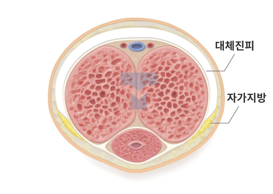 음경 단면도