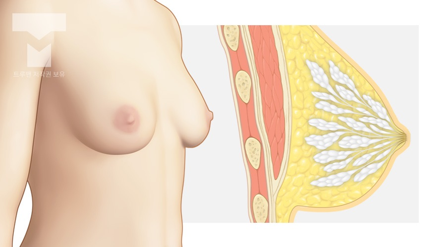 여성의 가슴