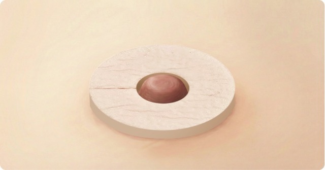 유두 보호 드레싱