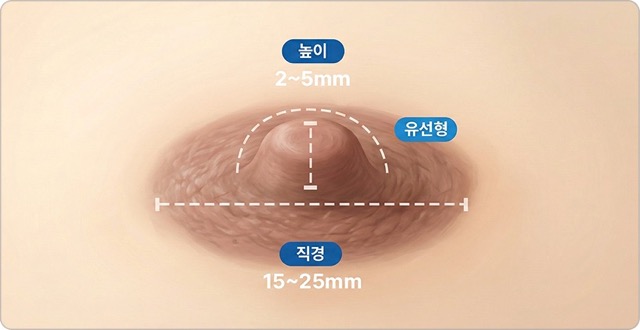 가슴 볼륨 조정 후