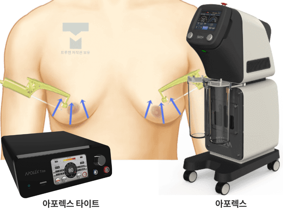 고주파 가슴 타이트닝 설명 이미지