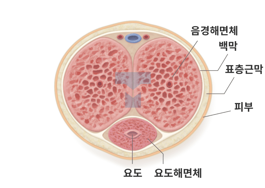 대체진피 확대 + 턱짐현상 해결