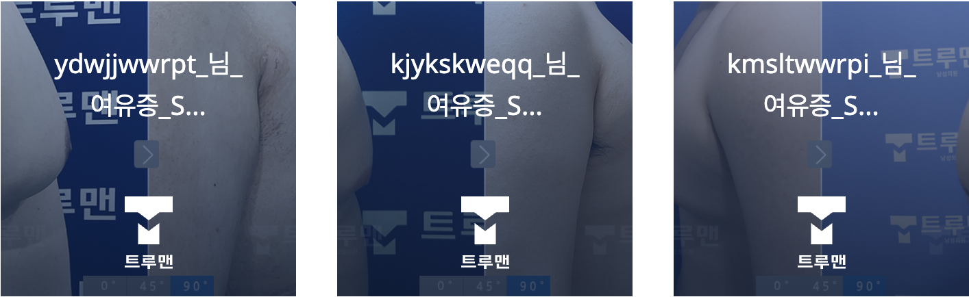 전후 사진 1