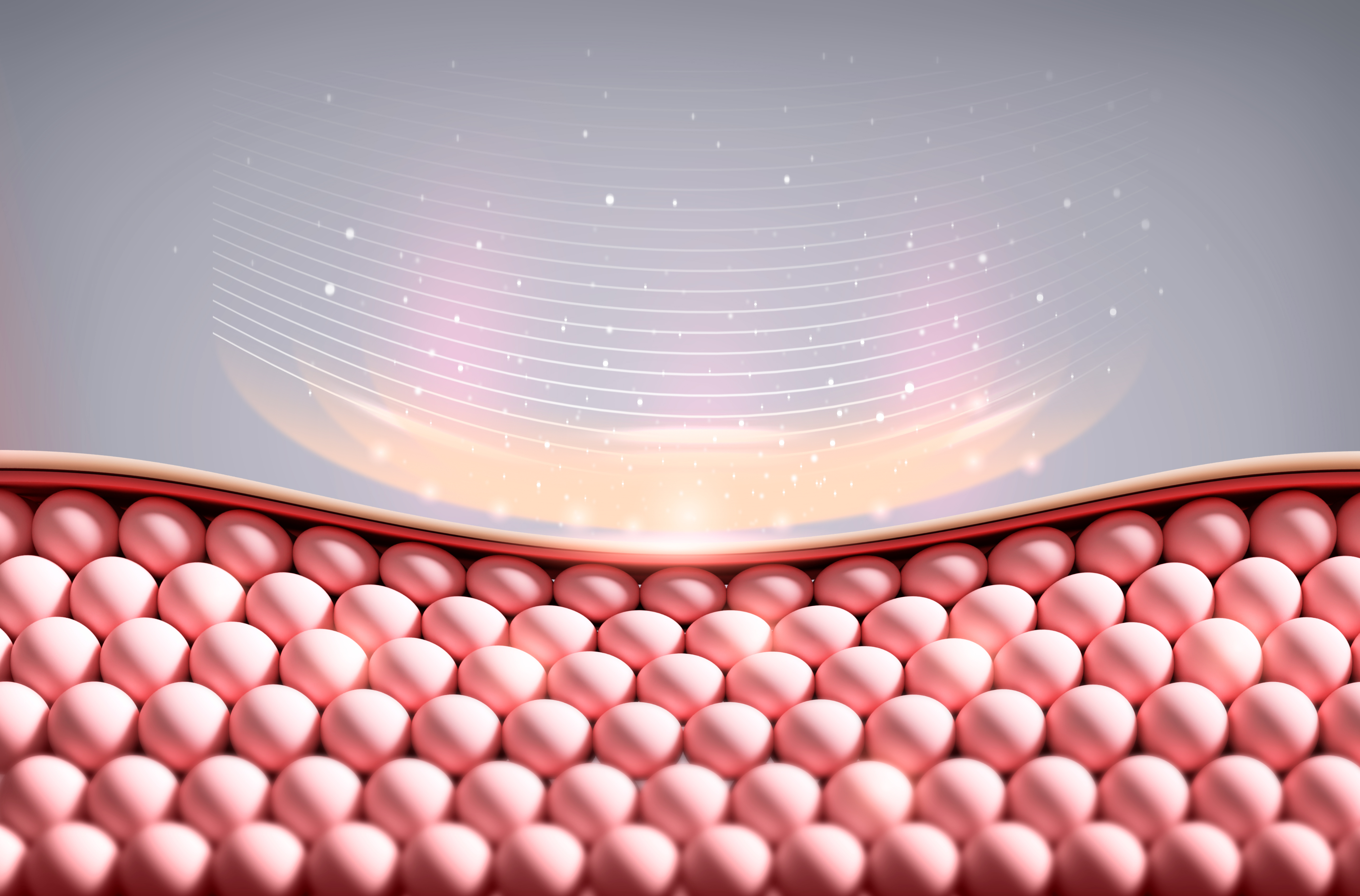 고주파 무료 지원