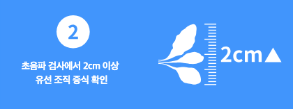 초음파 검사